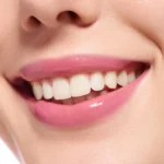 Essence Extreme Shine Volume Lipgloss 21 - Pretty in Pink 5ml - Image 4